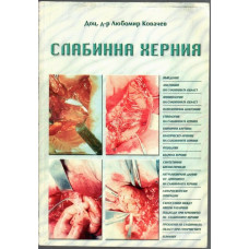 Слабинна херния