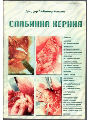 Слабинна херния