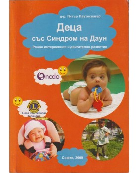 Деца със Синдром на Даун