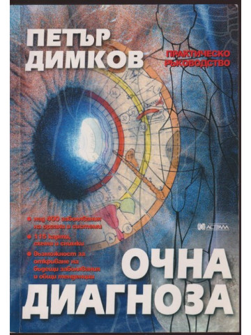 Очна диагноза Очна диагноза