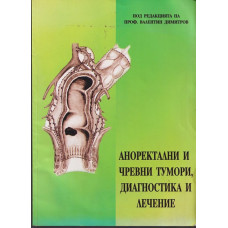 Аноректални и чревни тумори, диагностика и лечение