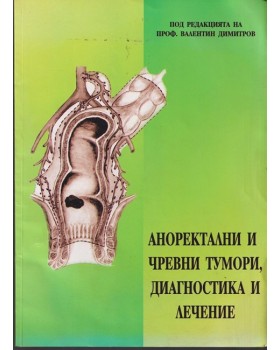 Аноректални и чревни тумори, диагностика и лечение