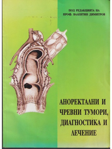 Аноректални и чревни тумори, диагностика и лечение Аноректални и чревни тумори, диагностика и лечение